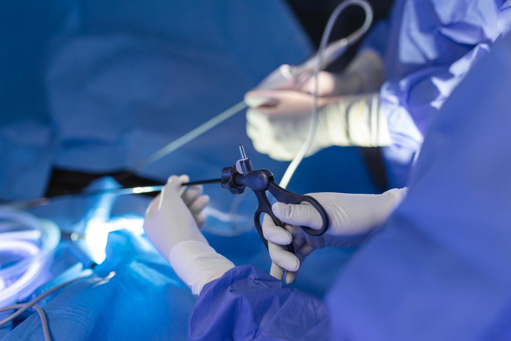Laparoscopic Bariatric Surgery